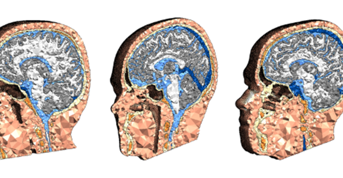 Brain
