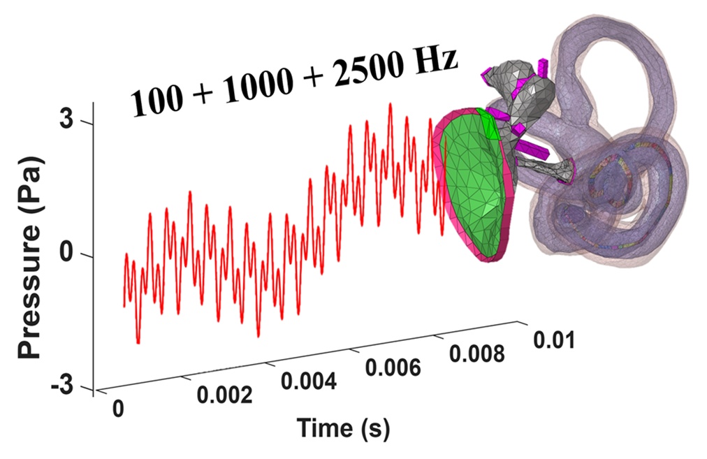 Whole-ear FE model and time-domain analysis