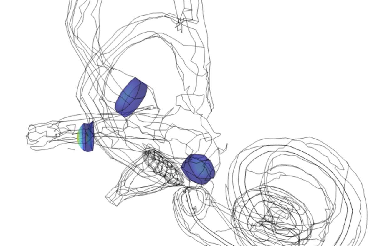 Cupula deformation under different rotations