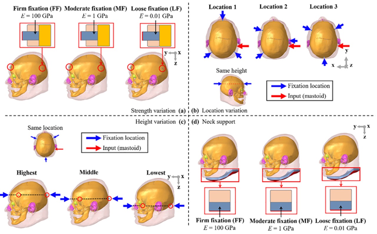 Effect of head fixation on bone-conduction response