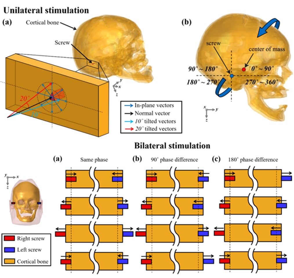 Effect of stimulus force direction on hearing