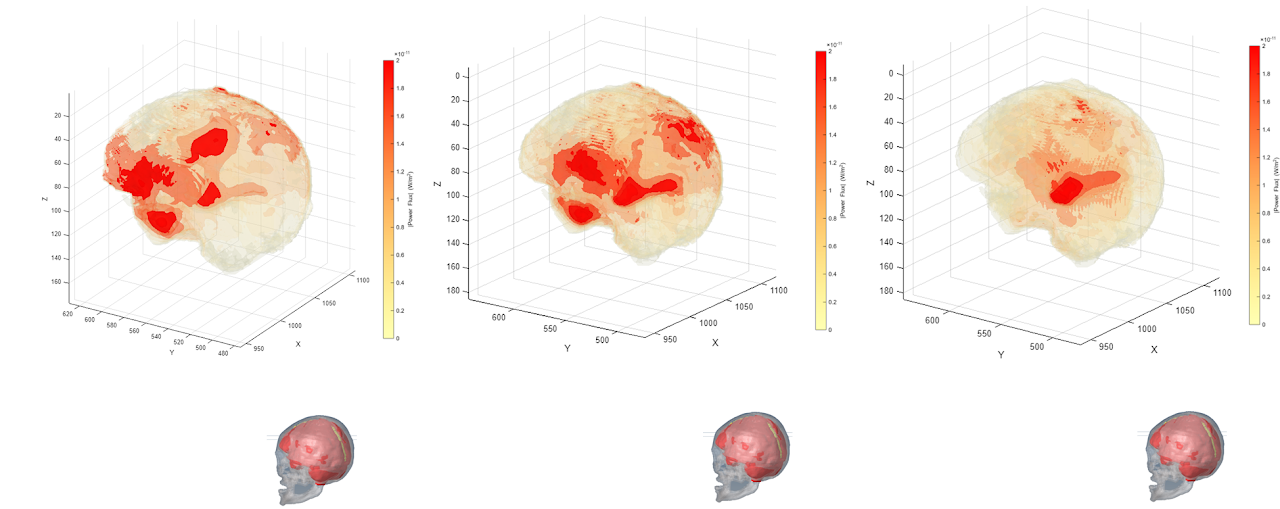 Energy transfer for stimulation-site combinations