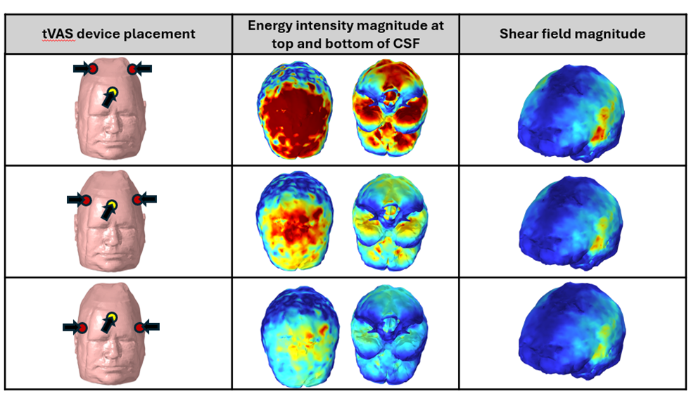 CSF simulation with a multiphysics head model