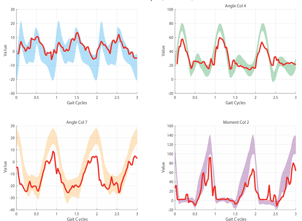 Gait-assist motion prediction