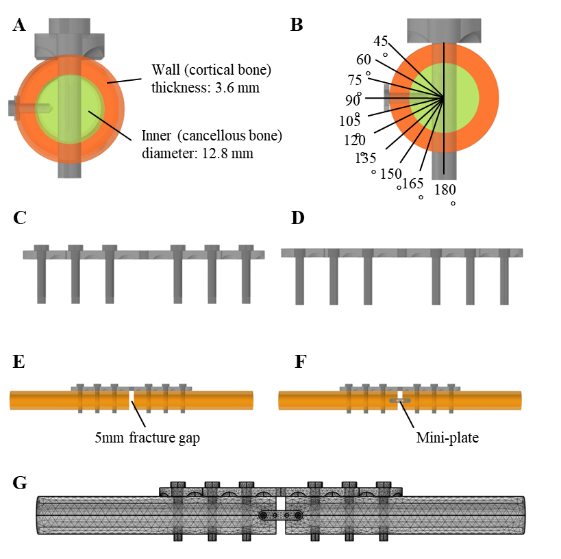 Structural analysis for stronger fracture fixation