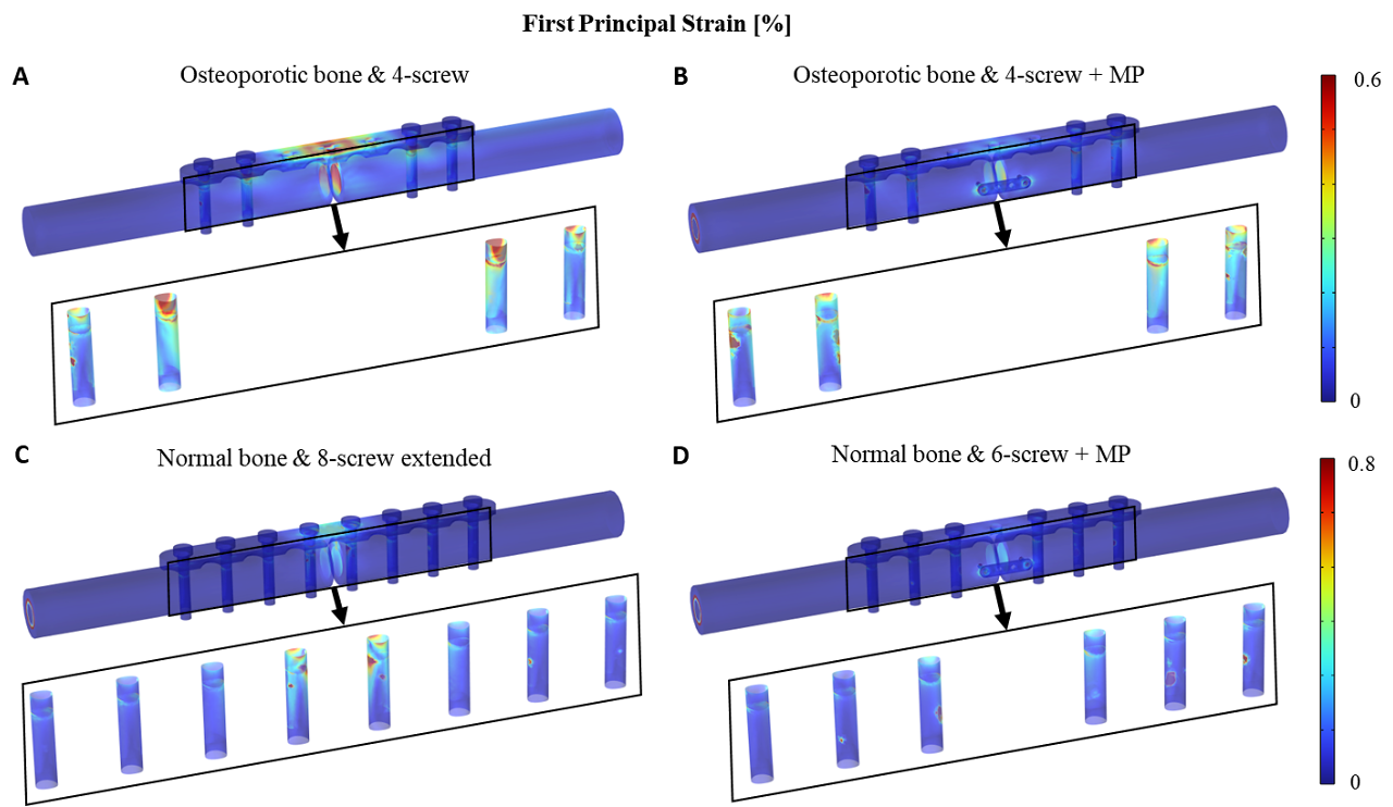 Structural analysis for stronger fracture fixation