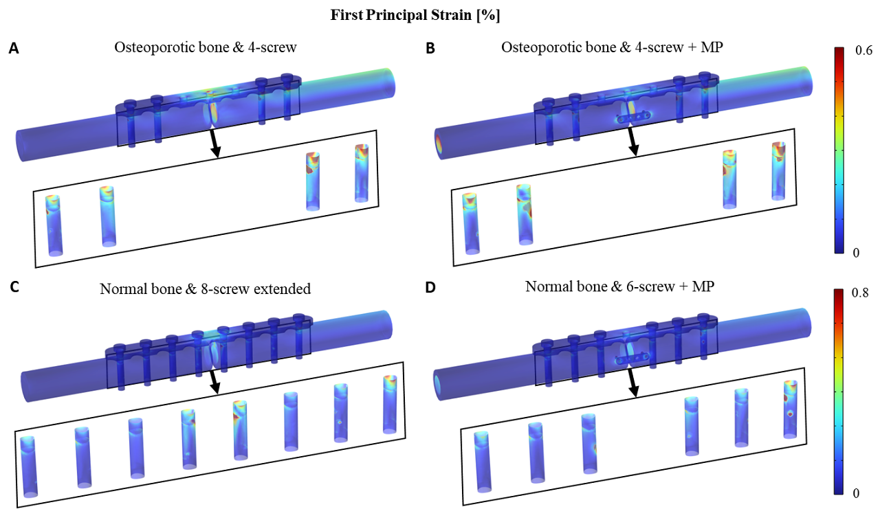 Structural analysis for stronger fracture fixation